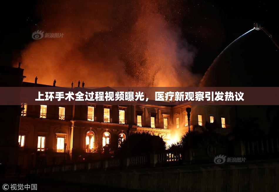 上环手术全过程视频曝光，医疗新观察引发热议