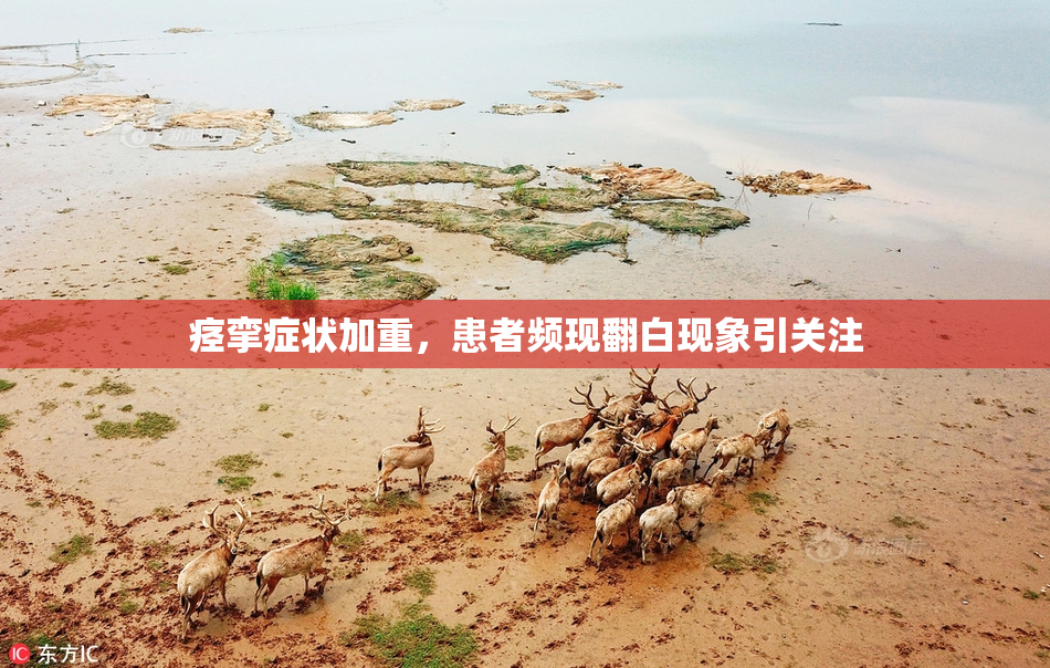 痉挛症状加重，患者频现翻白现象引关注