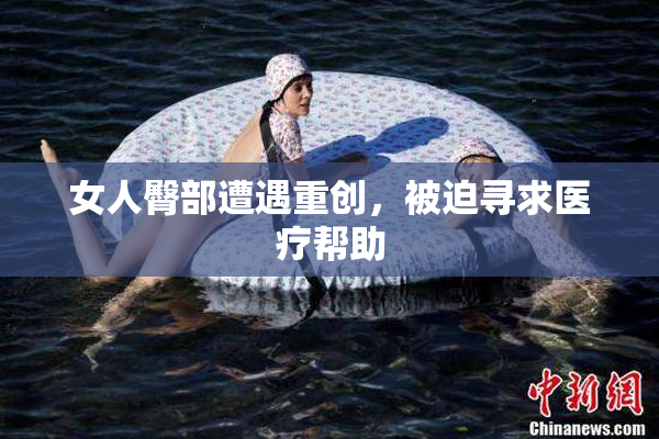女人臀部遭遇重创，被迫寻求医疗帮助