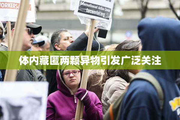 体内藏匿两颗异物引发广泛关注