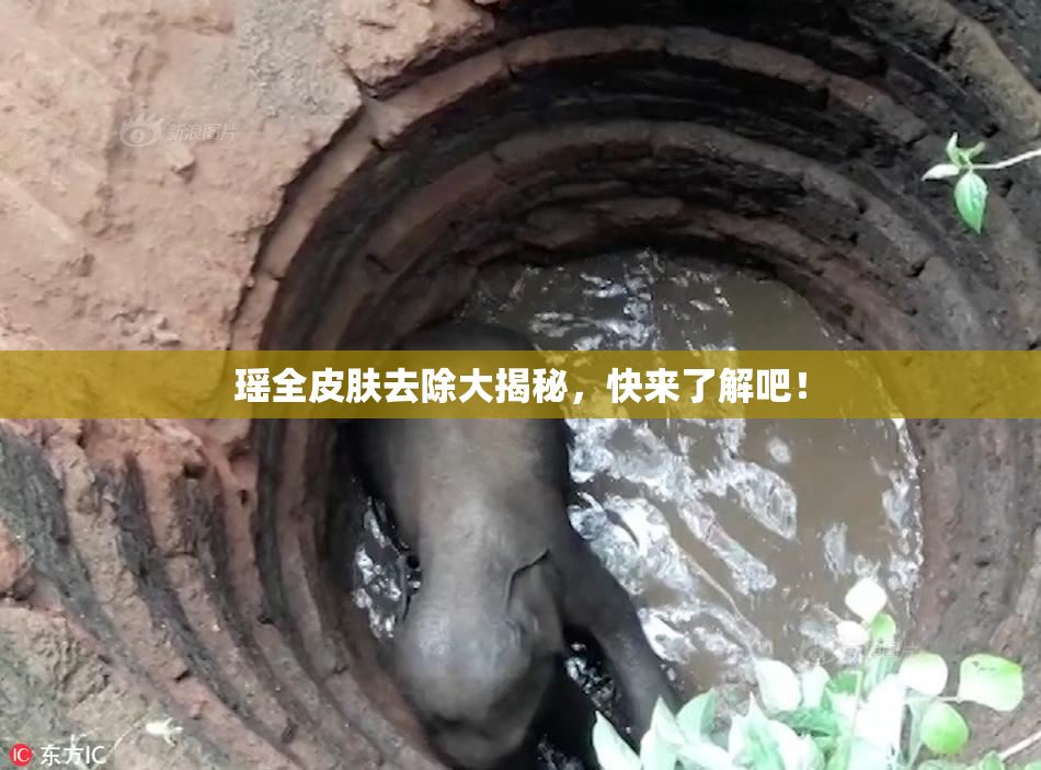 瑶全皮肤去除大揭秘，快来了解吧！