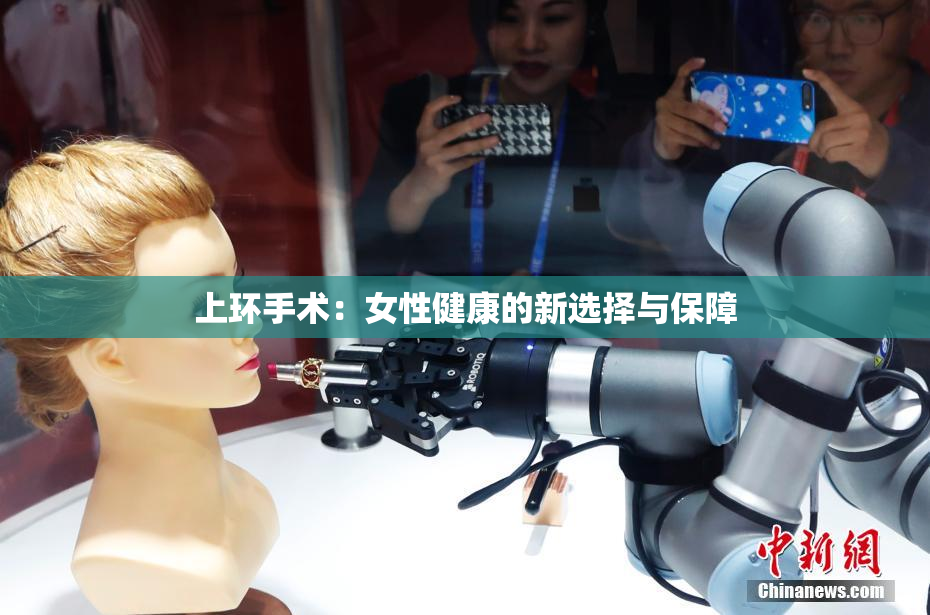 上环手术：女性健康的新选择与保障
