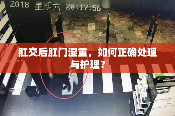 肛交后肛门湿重，如何正确处理与护理？