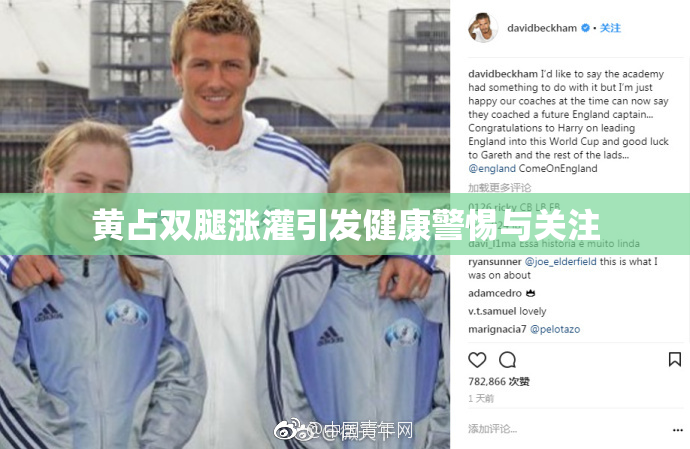黄占双腿涨灌引发健康警惕与关注