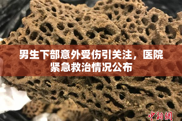 男生下部意外受伤引关注，医院紧急救治情况公布